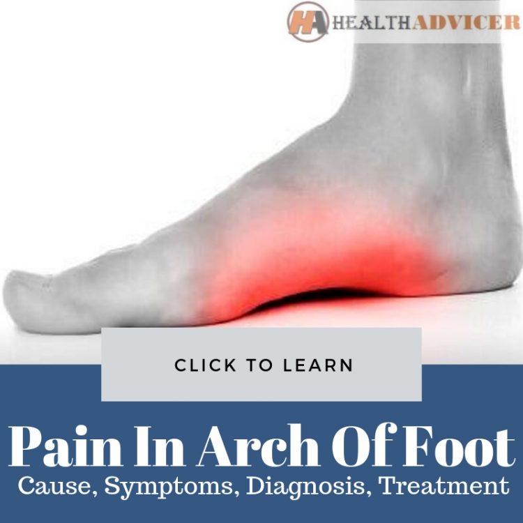 pain-in-arch-of-foot-causes-treatment-and-stretches