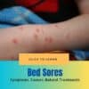 Bed Sores