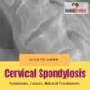 Cervical Spondylosis