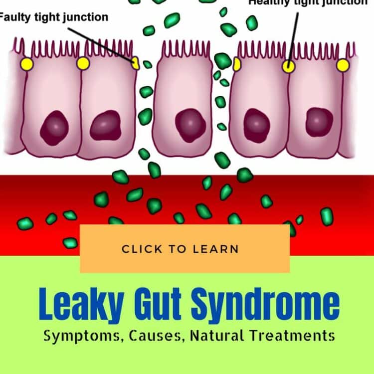 Leaky Gut Syndrome