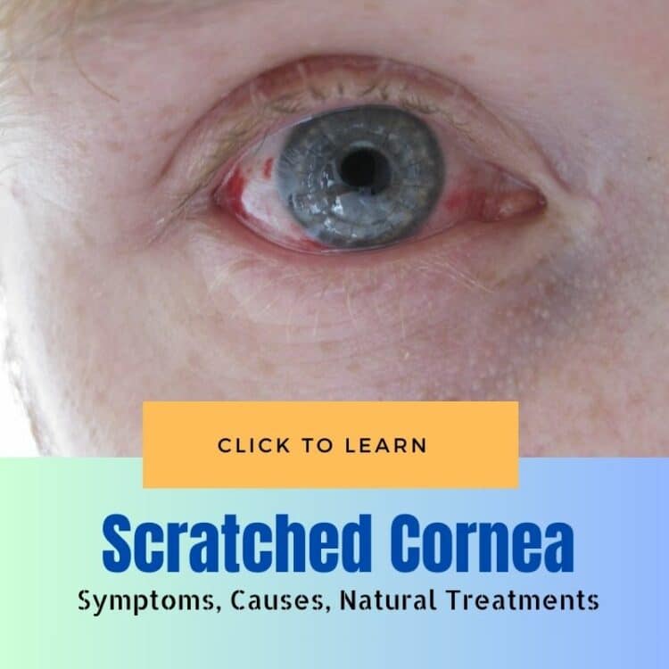 Scratched Cornea